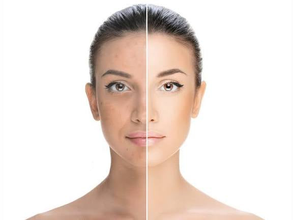 Kelly Pearl Cream – Daily Whitening & Glow Formula